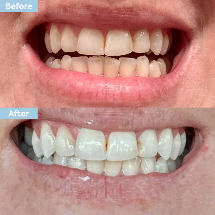 "Glowflora™ Pasta de Dentes Probiótica Branqueadora e de Hálito Fresco".