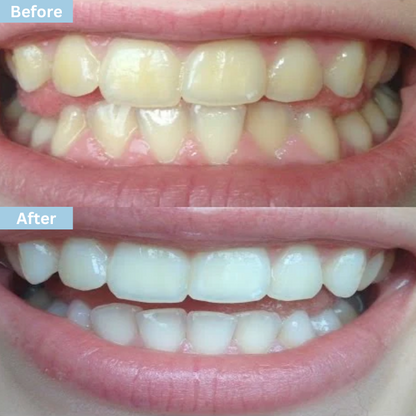"Glowflora™ Pasta de Dentes Probiótica Branqueadora e de Hálito Fresco".