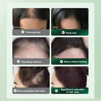 Solução Anti-Queda de Cabelo e Crescimento Capilar