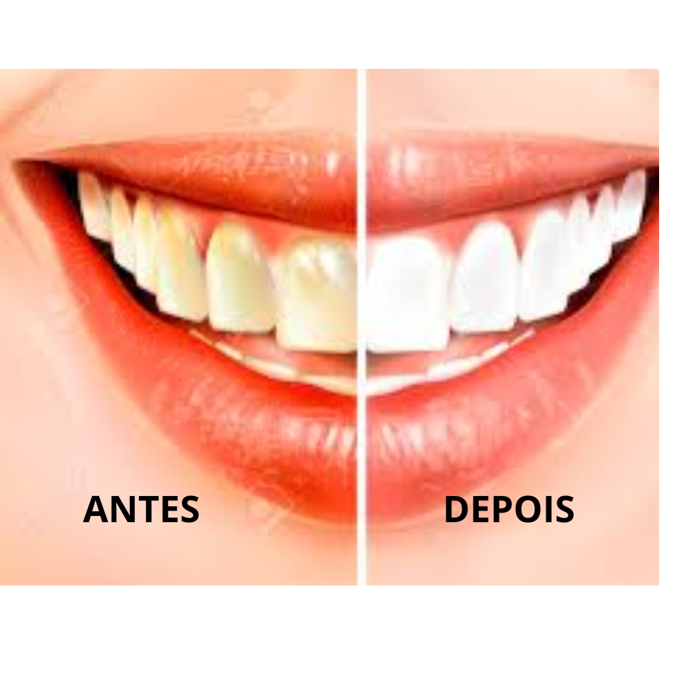 "Glowflora™ Pasta de Dentes Probiótica Branqueadora e de Hálito Fresco".
