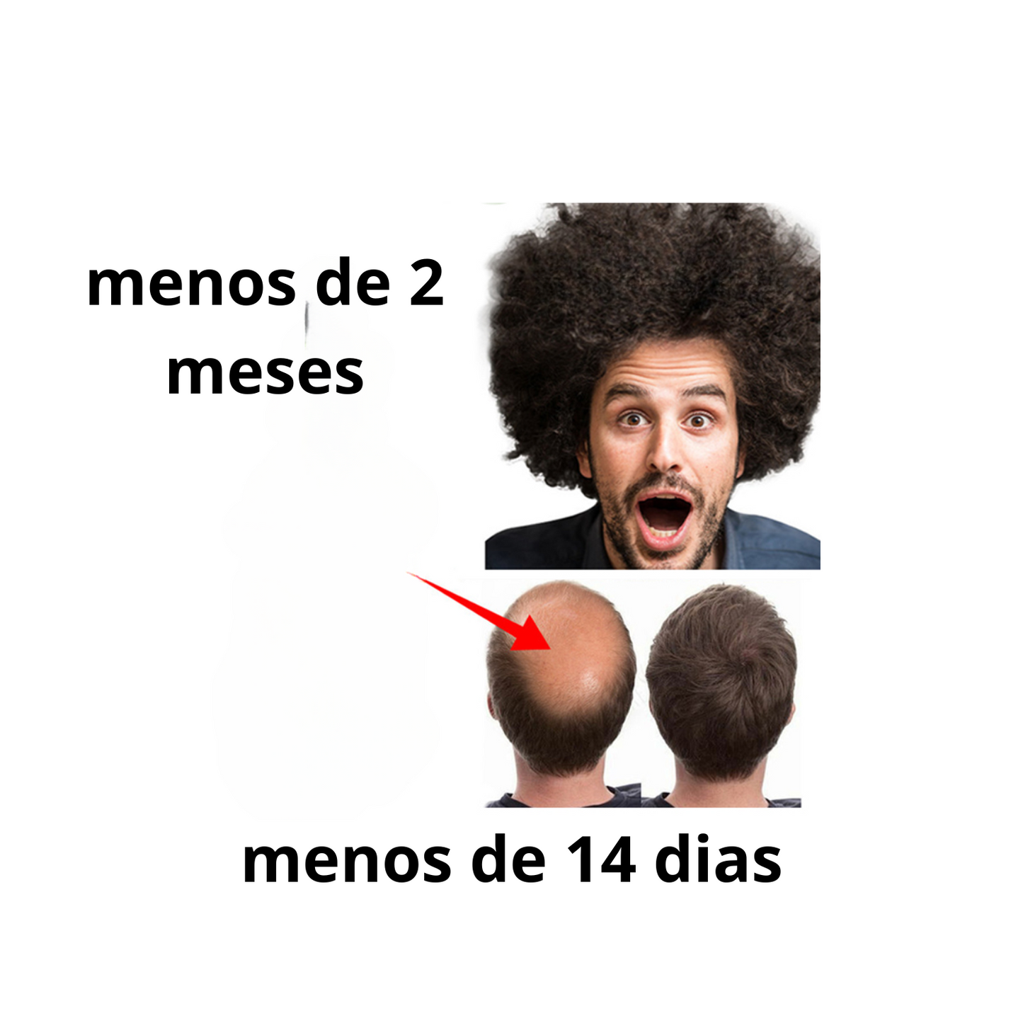 🌿 Spray Natural HZA™ para o Crescimento Capilar