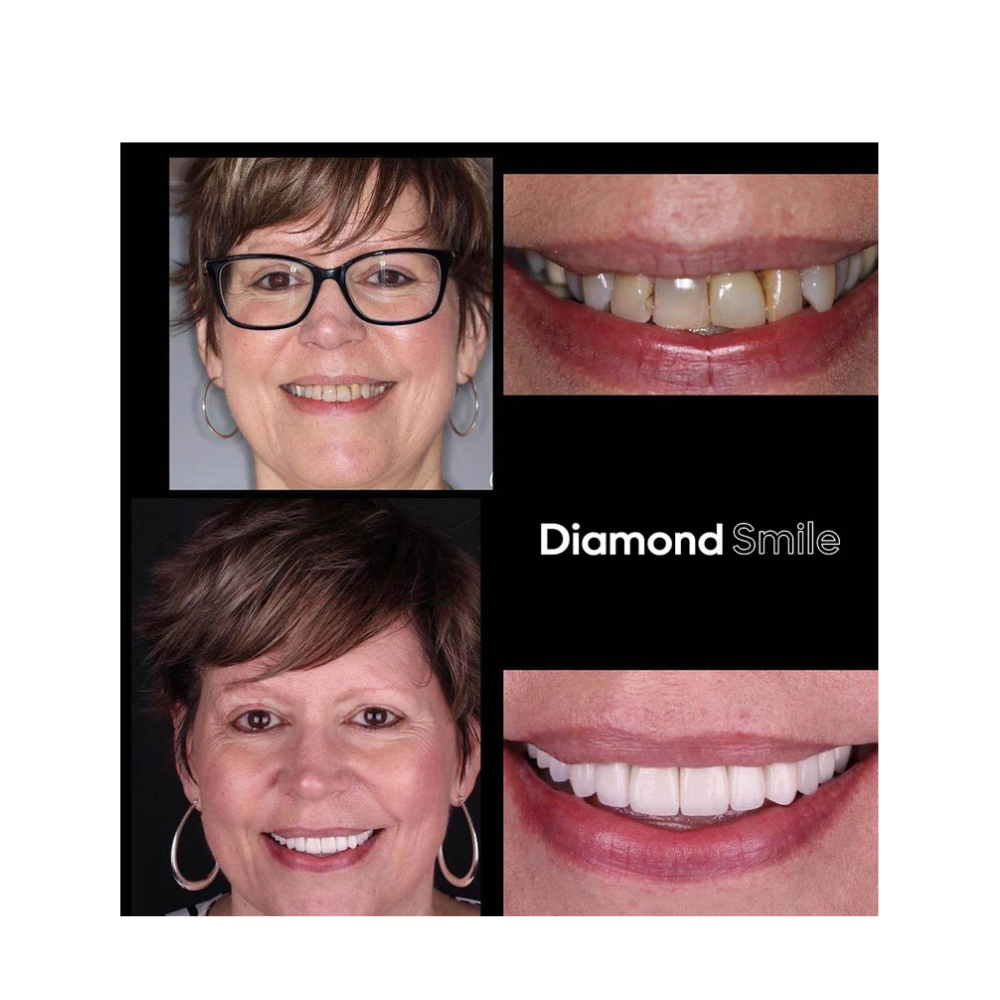 "Glowflora™ Pasta de Dentes Probiótica Branqueadora e de Hálito Fresco".