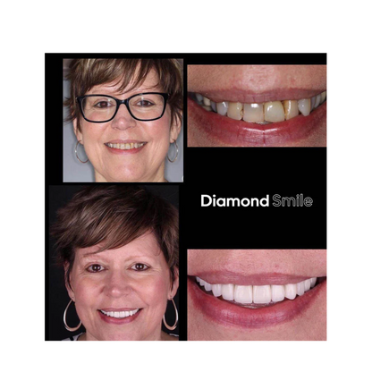 "Glowflora™ Pasta de Dentes Probiótica Branqueadora e de Hálito Fresco".
