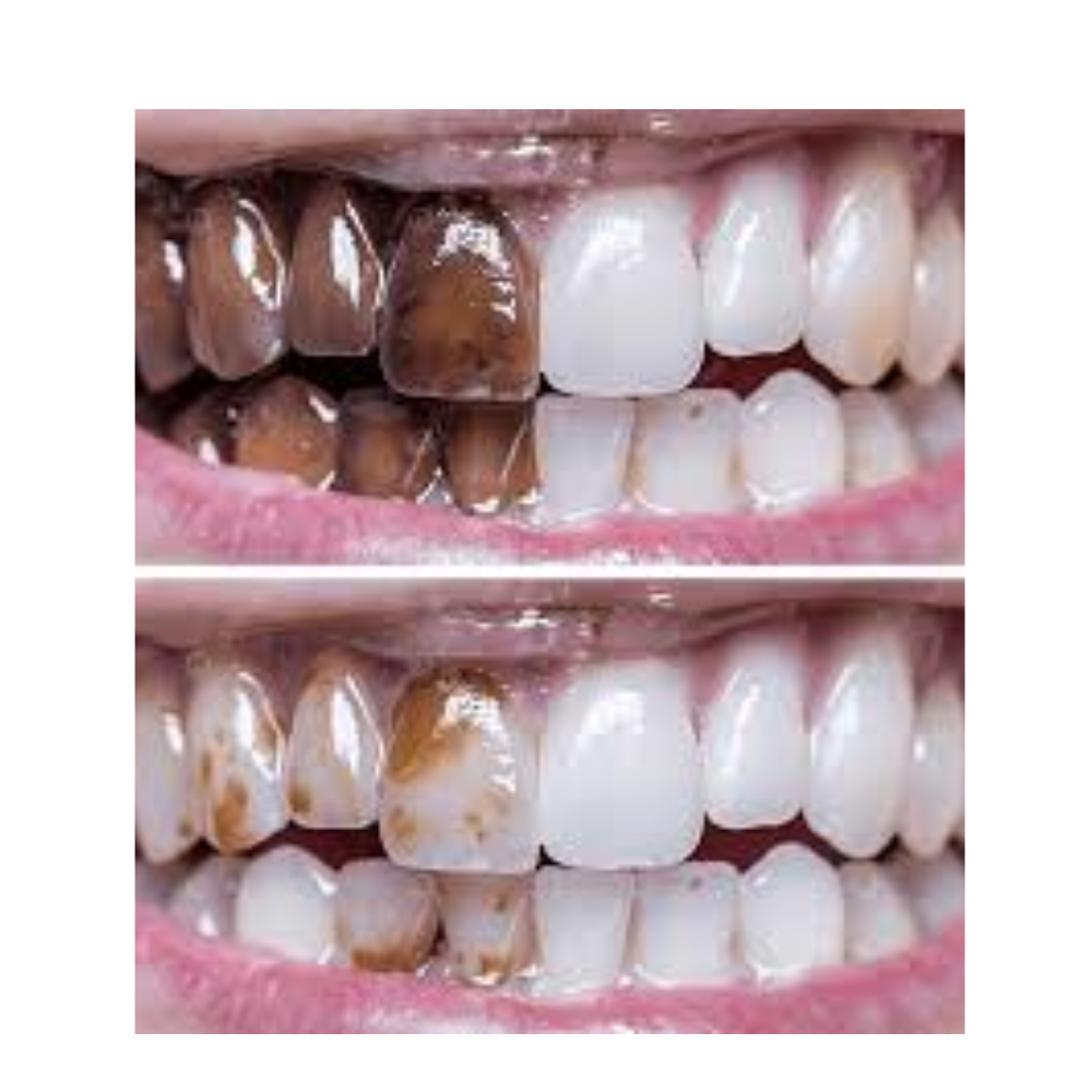 "Glowflora™ Pasta de Dentes Probiótica Branqueadora e de Hálito Fresco".